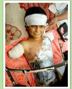 What does Ali, who had his arms blown off by an American drone, mean to theologians?